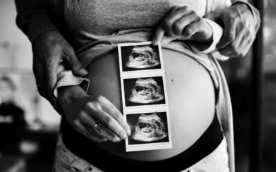 Prenatal Care in the First Month: A Vital Start for a Healthy Pregnancy